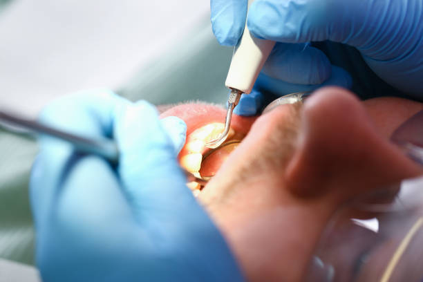 Best Urgent Dental Care for Toothaches in Kennesaw State University, GA
