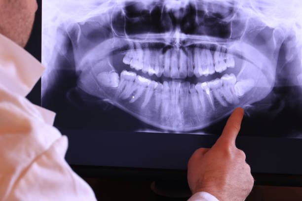 Best Broken or Chipped Tooth Repair in Kennesaw State University, GA