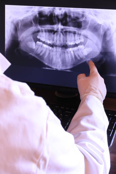 Best Broken or Chipped Tooth Repair in Kennesaw State University, GA